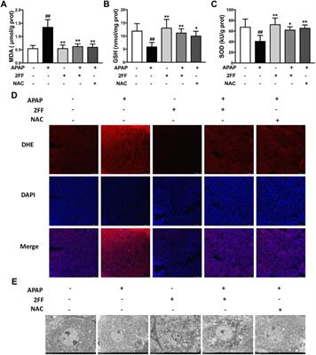 Inhibition of fucosylation by 2-fluorofucose attenuated acetaminophen-induced liver injury via its anti-inflammation and anti-oxidative stress effects